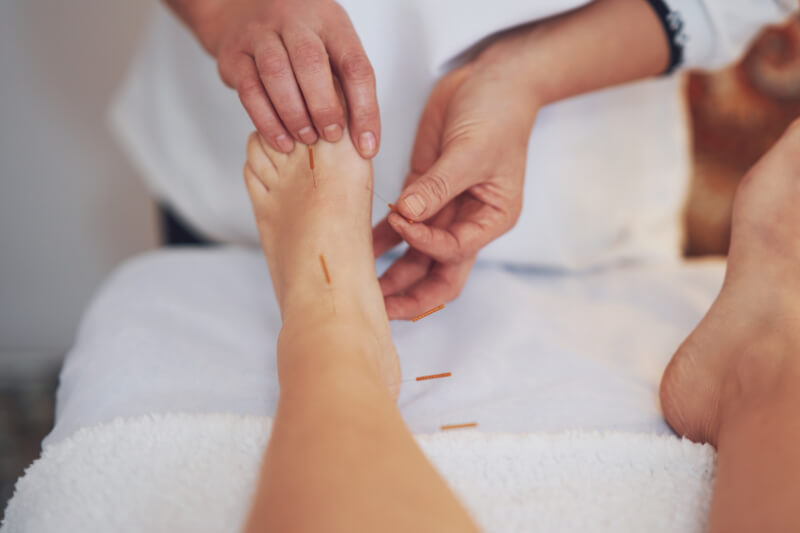 acupuncture for weight loss foot