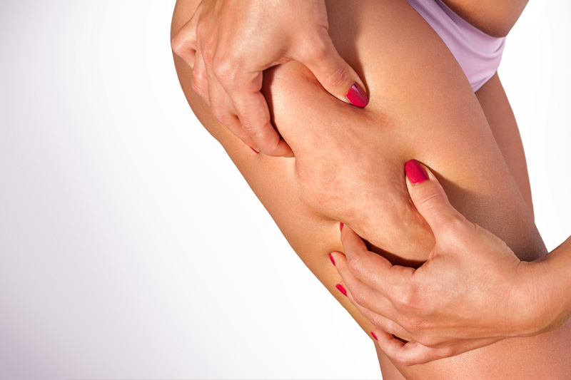 solution efficace pour faire disparaitre la cellulite