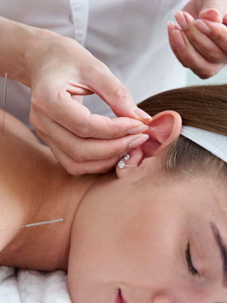 Acupuncture pour maigrir : quels points stimuler ?